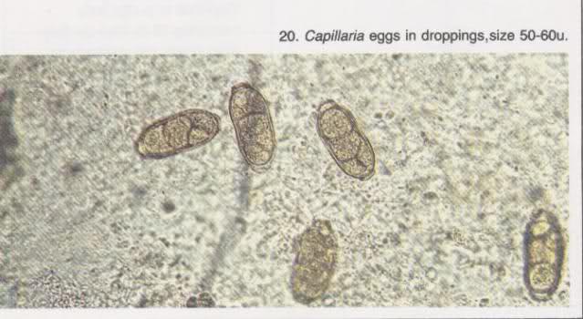 capillaria eggs micro