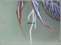 tapeworms1